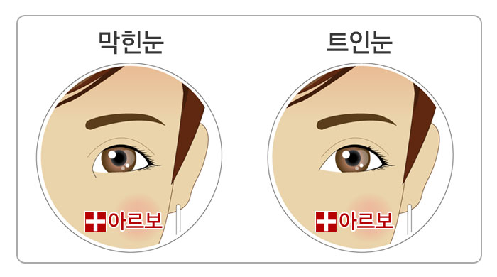 눈관상,막힘정도로보는눈관상,막힌눈,트인눈,막힌눈관상,트인눈관상