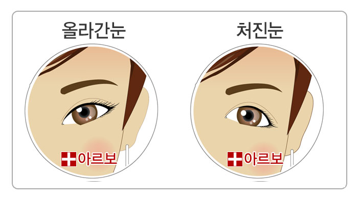 올라간정도눈관상,눈관상,올라간눈관상,처진눈관상,올라간눈,처진눈,여우눈,너구리눈