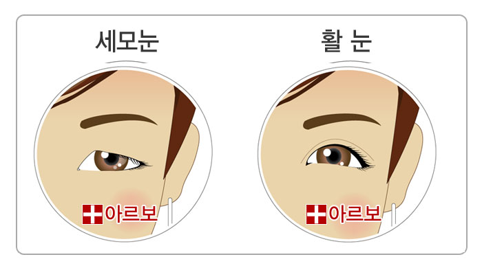 눈관상,세모눈,활눈,세모눈관상,활눈관상